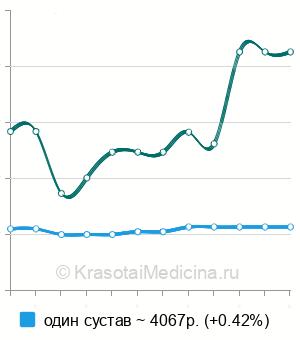 Средняя стоимость МРТ височно-нижнечелюстных суставов в Краснодаре