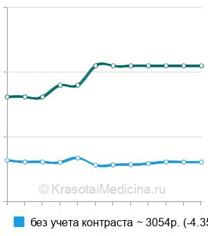 Средняя стоимость МРТ орбит и зрительных нервов в Краснодаре