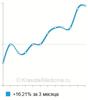 Средняя стоимость МРТ кисти в Краснодаре