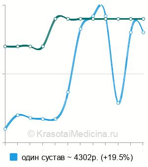 Средняя стоимость МРТ локтевого сустава в Краснодаре