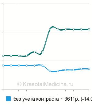 Средняя стоимость МРТ наружных половых органов у мужчин в Краснодаре