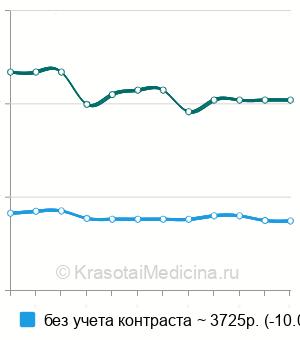 Средняя стоимость МРТ мягких тканей (1 локализация) в Краснодаре