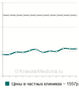 Средняя стоимость антител к микросомальной фракции печени и почек (анти-LKM) в Краснодаре