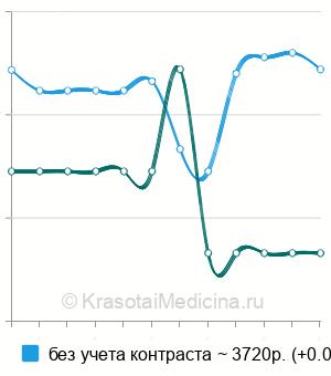 Средняя стоимость экскреторной урографии в Краснодаре
