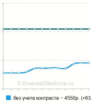 Средняя стоимость МРТ сосудов головного мозга в Краснодаре