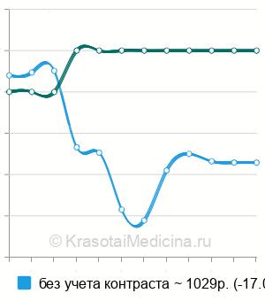 Средняя стоимость рентген околоносовых пазух в Краснодаре