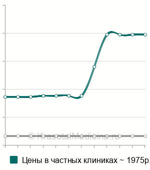Средняя стоимость сегментарный массаж пояснично-крестцового отдела позвоночника в Краснодаре