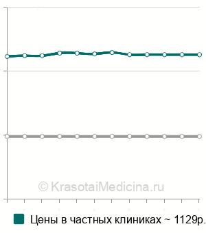 Средняя стоимость посев на уреаплазму с определением чувствительности в Краснодаре