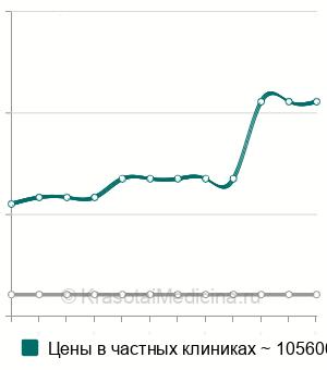 Средняя стоимость лаваж сустава в Краснодаре