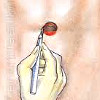 Пупочная грыжа у ребенка операция в краснодаре thumbnail