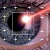 Лазерное лечение глаз в краснодаре