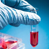 Анализ крови на муциноподобный рако-ассоциированный антиген (MCA)
