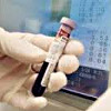 Чувствительность лейкоцитов к иммуномодуляторам